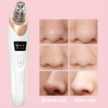 Seralyd Clarify Pro™