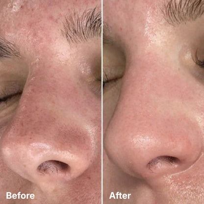 Seralyd Clarify Pro™